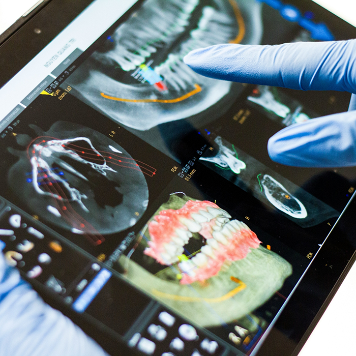 Gloved hand pointing to digital X-ray