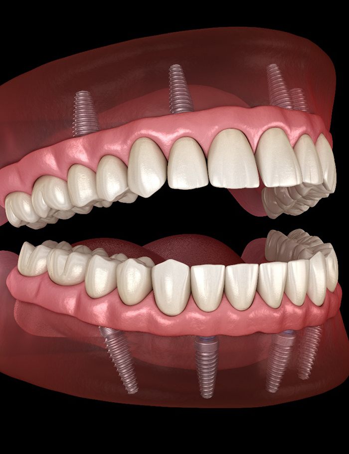 Man brushing his teeth