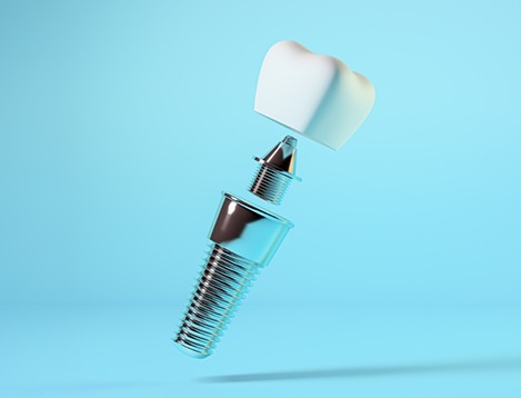 Dental implant post abutment and crown