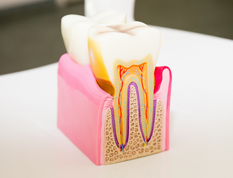 Model showing inner layers of tooth