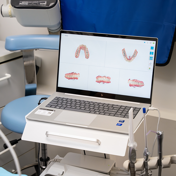 Renders of teeth on laptop