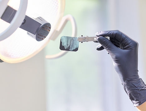 Holding up a small intraoral X-ray