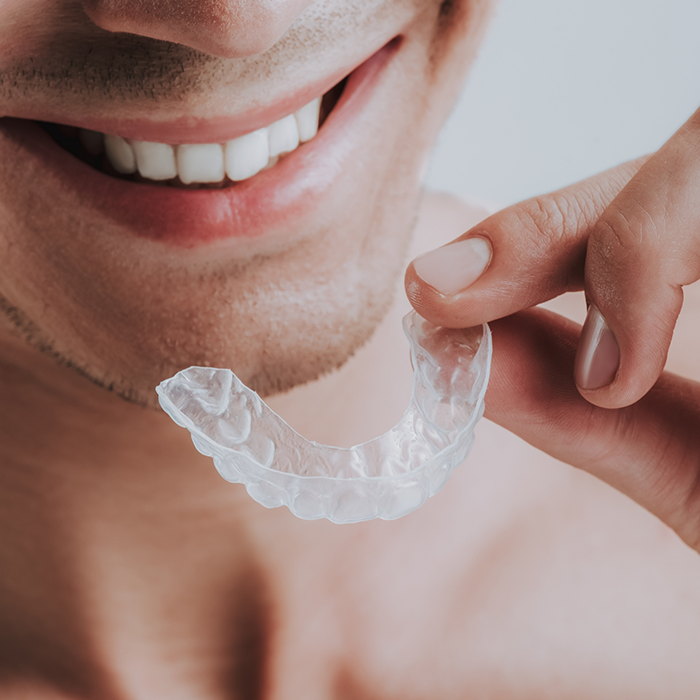 Close-up of man putting in nightguard for bruxism